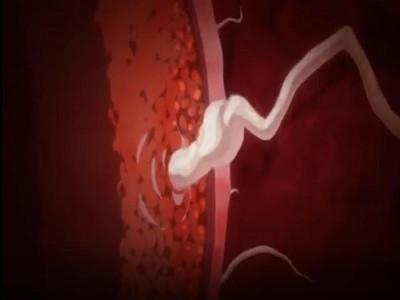 Thumbnail of post image 121